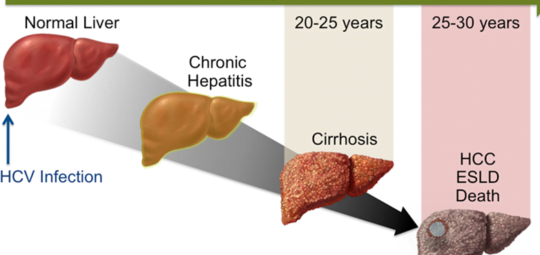 chronic-liver-disease-evaluation-program-cubaheal