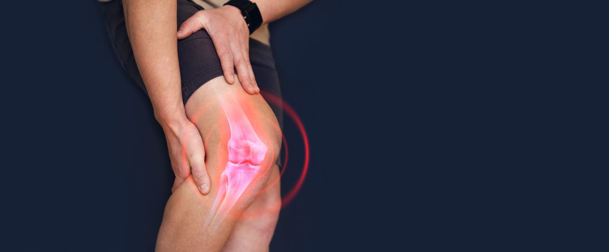Angular Deformity of Knee/ Genu Valgum (Knock Knee) - CubaHeal