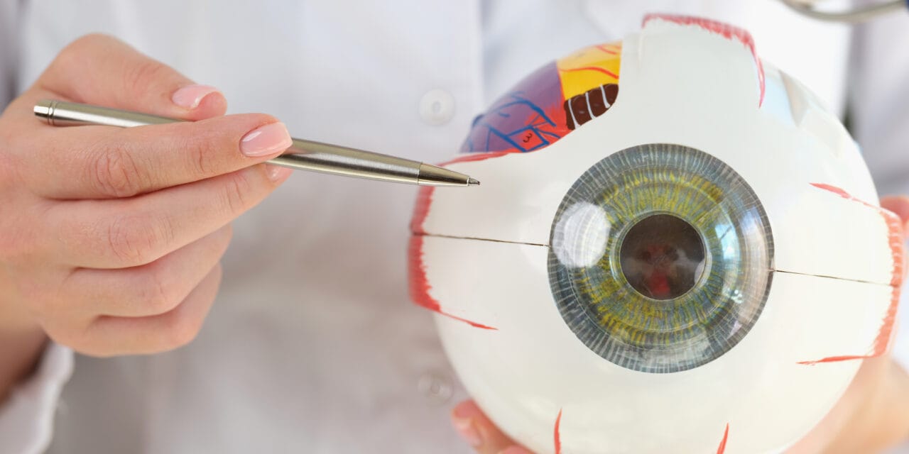 Cataract Surgery Lens Options: How IOL Choices Differ