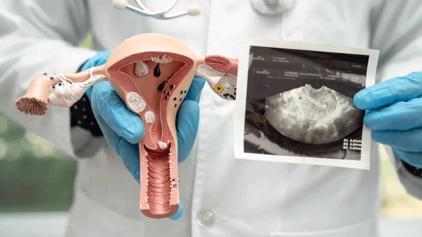 Cervical Cancer Treatment